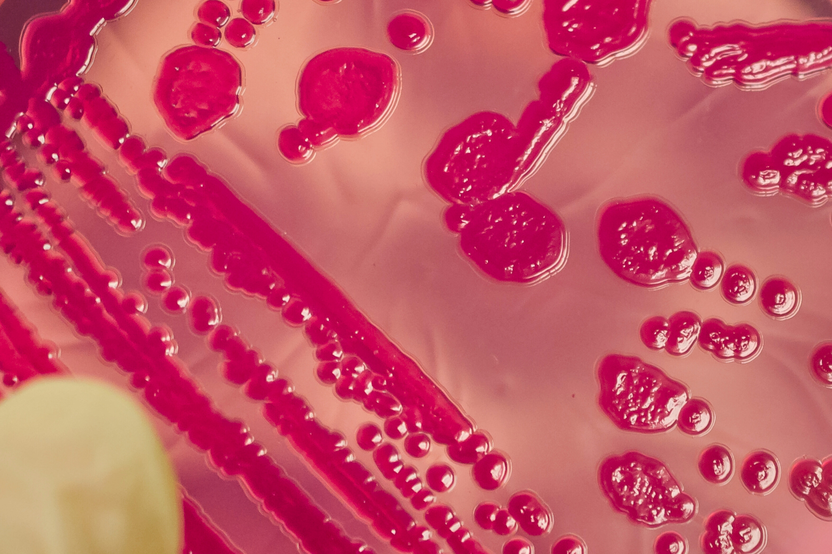 Salmonella spp.