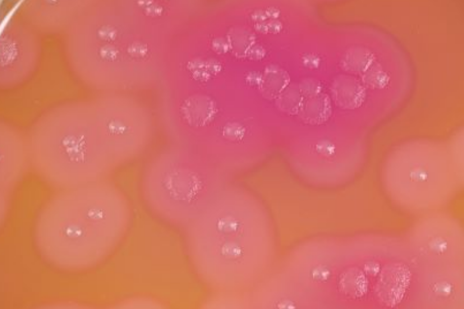 Bacillus cereus