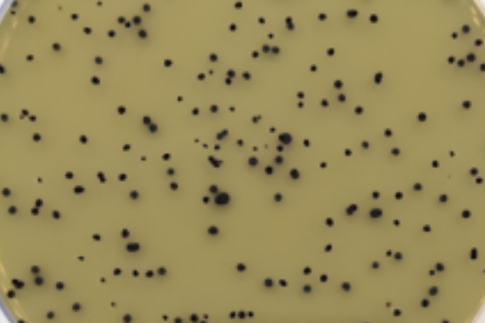 Clostridium