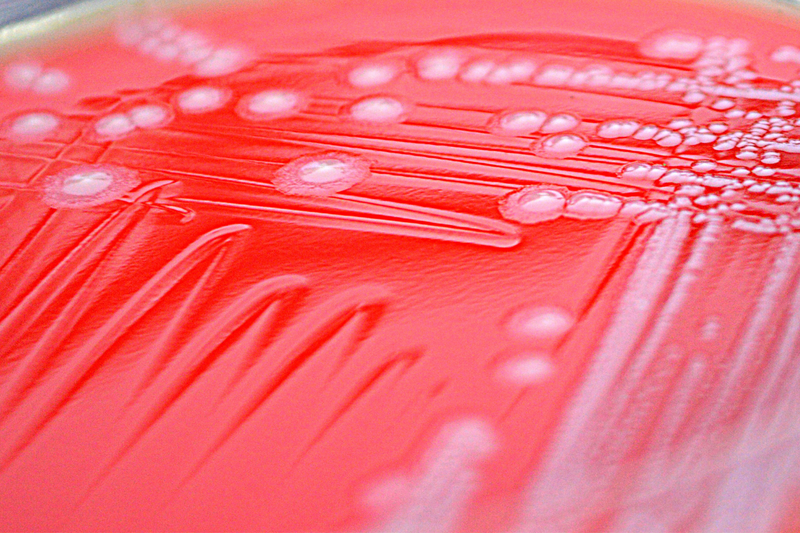 E. coli